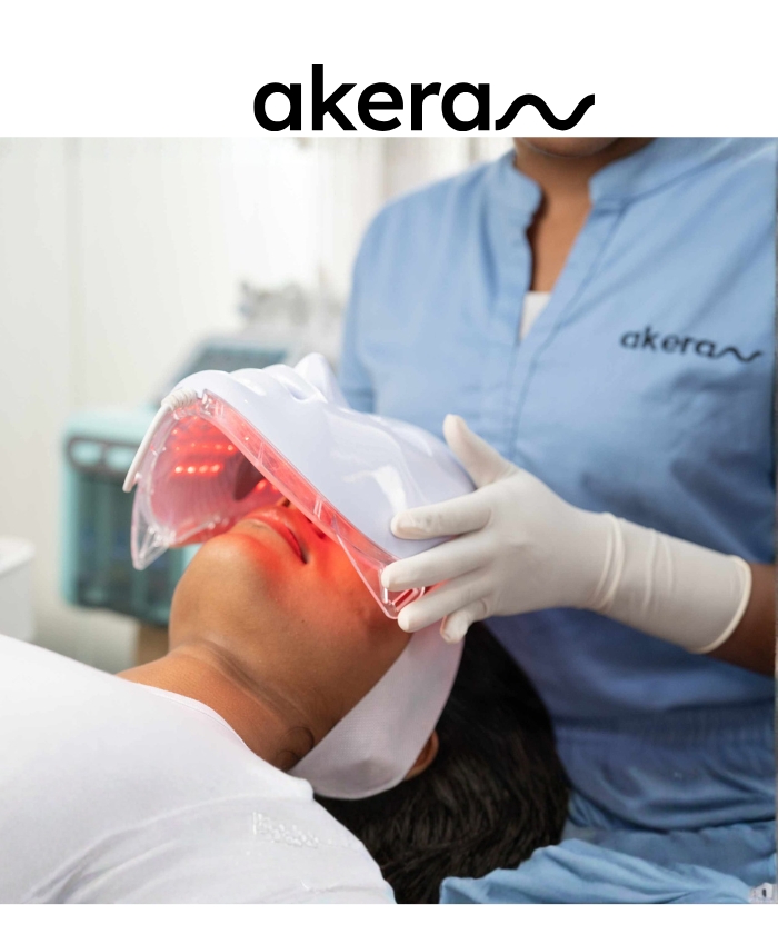 Akera